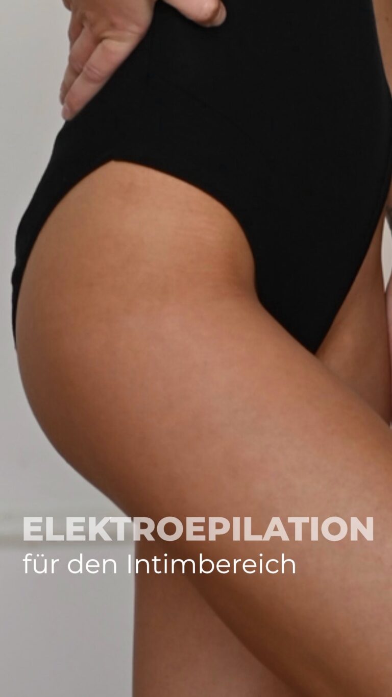 Dauerhafte Haarentfernung Mönchengladbach 1 Elektroepilation Bikini- und Intimbereich im Studio Electroepil Angels Mönchengladbach