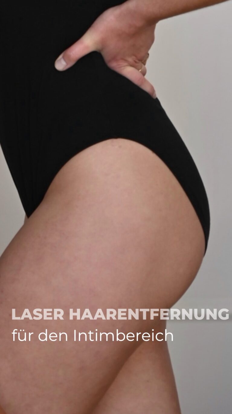 Dauerhafte Haarentfernung Mönchengladbach 6 Laser-Haarentfernung Bikini- und Beinzone im Studio Electroepil Angels Mönchengladbach